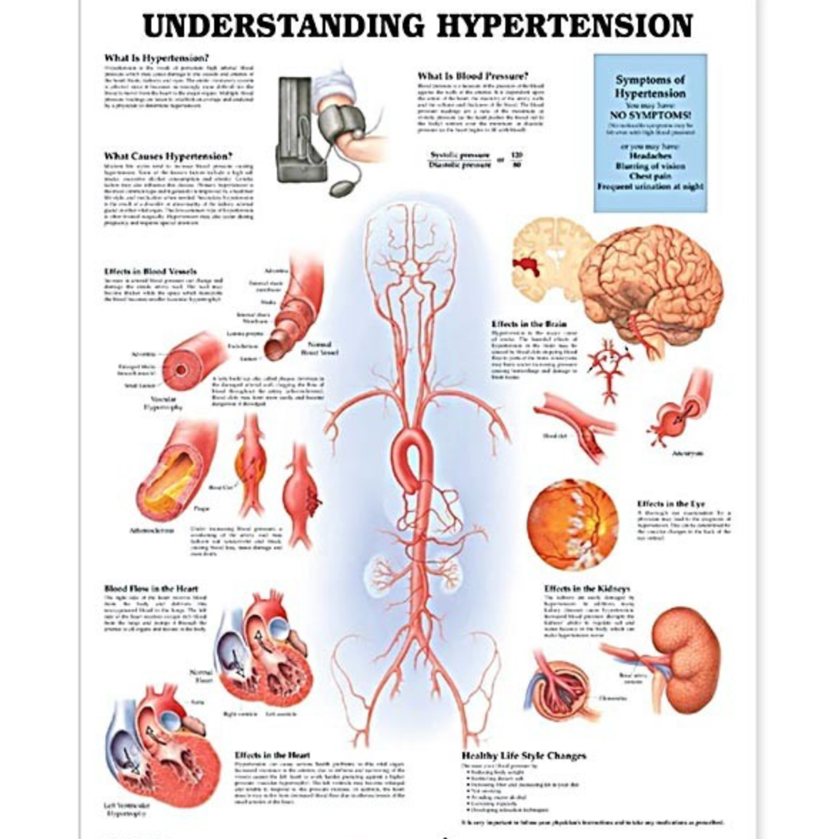 Understanding Hypertension Chart